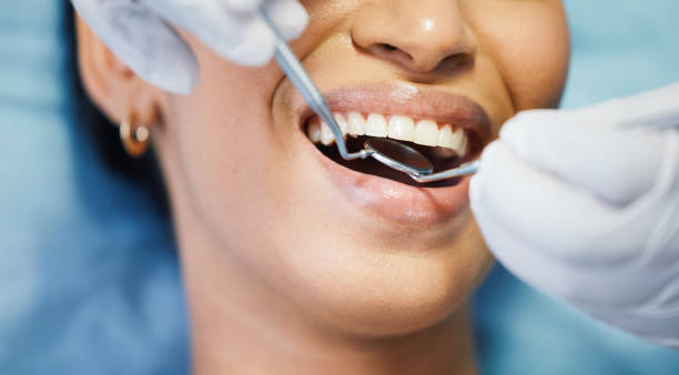 Best Emergency Tooth Extraction in Flint Hill, MO