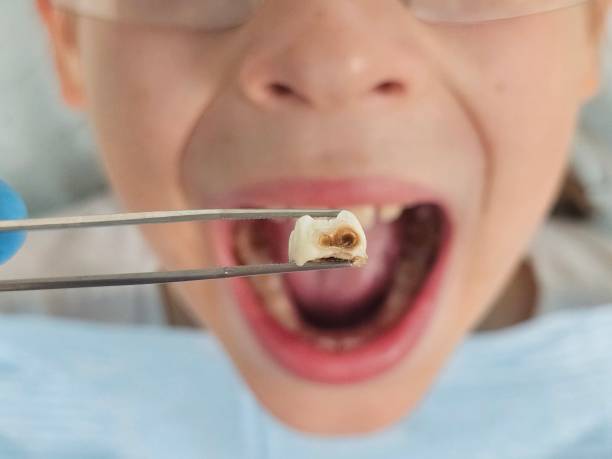 Best Pediatric Emergency Dentist in Flint Hill, MO