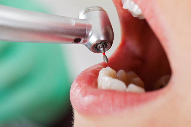 Best Emergency Dental Surgery in Flint Hill, MO